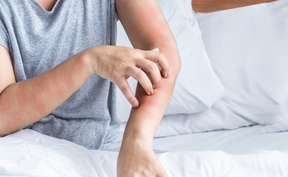 Allergen & Dust Mite Removal